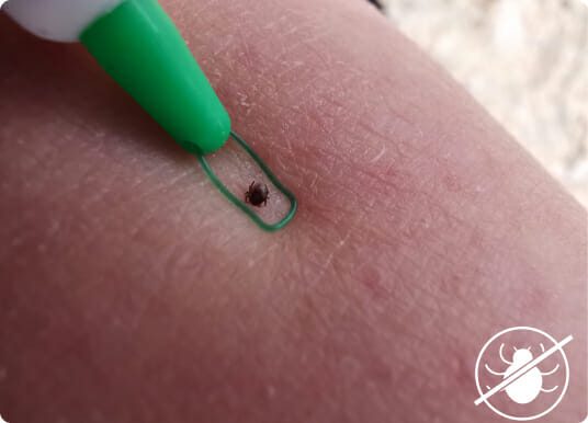 Ticks