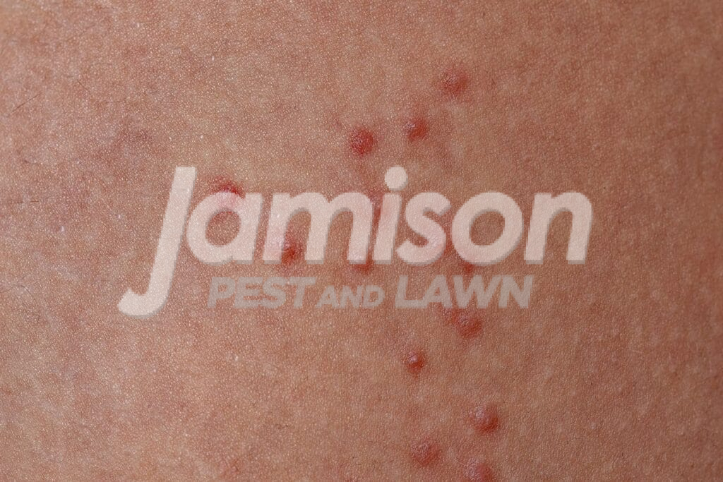 Ticks Allergic Ticks allergic